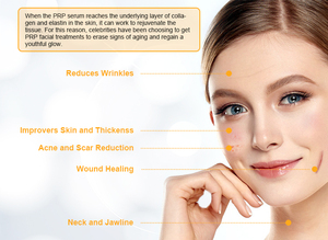 <span class=keywords><strong>Manson</strong></span> 10Ml Medische <span class=keywords><strong>Prp</strong></span> Activator Buis Vacuüm Bloedafname Reageerbuis - Product Image 5