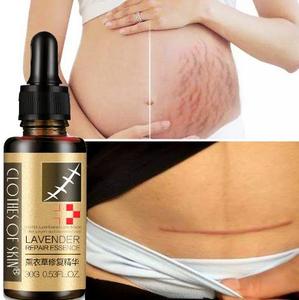 Benutzer definiertes Logo Schwangere Frauen Hyaluron säure Serum öl Ätherisches Gesicht Ätherische Massage Narben entfernung Lavendelöl - Product Image 4