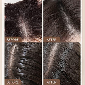 Shampoo à l'huile de menthe poivrée botanique |   Formule pour la repousse des cheveux avec kératine pour cheveux clairsemés |   Combattre la perte de cheveux pour hommes et femmes - Product Image 4