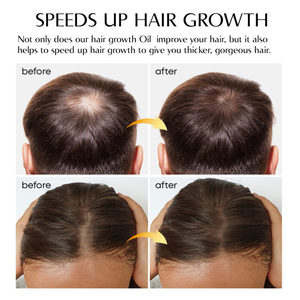 Aceite para el crecimiento del cabello MELAO OEM con jengibre, suero hidratante para el tratamiento de la barba y el cuero cabelludo para hombres y mujeres, aceite de raíz de jengibre - Product Image 3