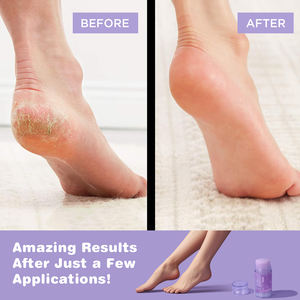 <span class=keywords><strong>Solo</strong></span> logotipo personalizado estándar lavanda Bálsamo hidratante para pies Anti Chaps Stick invierno bálsamo antigrietas - Product Image 2