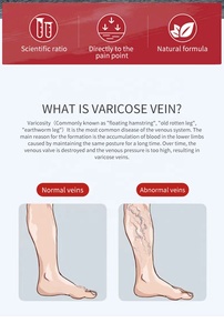 Hot Selling MQ Varicose Veins <b>Patch</b> Made In China Factory Wholesale With CE 12 <b>Patches</b> - Product Image 6