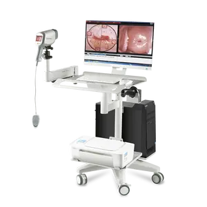 Colposcope de vidéo d'hôpital, caméra de gynéologie, Colposcope optique, Colposcope numérique, prix