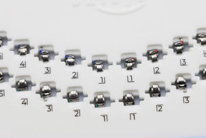 Bretelle dentistiche ortodontiche di nuovo arrivo staffa ortodontica dentale bretelle ortodontica ortodontici prodotti di consumo - Product Image 3