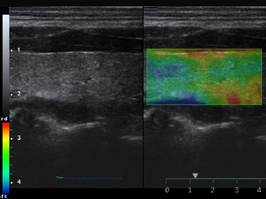 C59 Portable High-End <span class=keywords><strong>Echo</strong></span> untuk Kardiologi <span class=keywords><strong>2D</strong></span> 3D 4D Color <span class=keywords><strong>Doppler</strong></span> Veteriner & Manusia Portable Ultraosund untuk Pemeriksaan Jantung - Product Image 3
