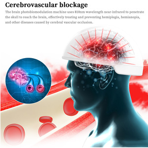 Suyzeko Transcranial manyetik beyin stimülasyonu 810nm kızılötesi rehabilitasyon tPBM Photobiomodulation kask - Product Image 2