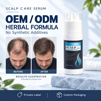 Ekstrak Nabati Perawatan Kulit Kepala yang Lembut Mengurangi Penipisan Rambut Kemasan Khusus Label Pribadi OEM ODM Serum Revitalisasi Kulit Kepala