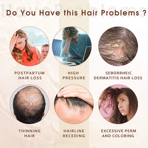 Le traitement à la biotine favorise la stimulation des racines des cheveux Huile essentielle répare le sérum de croissance des cheveux endommagés - Product Image 3