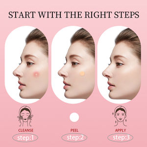 Patchs Hydrocolloïdes Imperméables et Respirants pour l'Acné – Traitement Rapide et Discret de l'Acné, Absorption du Pus – Produits de Soin Cutané - Product Image 3