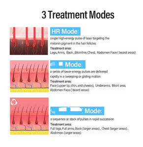 El Nuevo Modelo 2 en 1 Mejorado Presenta un Dispositivo de Depilación Manual con Diodo de Matriz de Puntos a Nivel Milimétrico. - Product Image 5