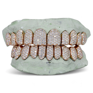 Grillz Moissanite VVS 10 sur 10 de Haute Qualité, Bijoux Hip Hop Personnalisés, Plaqué Or, Argent 925, Effet Givré, Cadeau de Fête Unisexe - Product Image 2