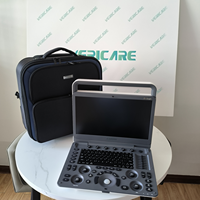 Échographe vétérinaire portable SonoScape Ultrasound E1 ExpV, Doppler couleur, E1 Exp pour l'imagerie diagnostique animale
