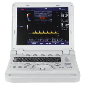 CONTEC CMS1700A doppler color máquina de ultrasonido doppler color sistema de ultrasonido