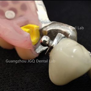 Prothèses dentaires amovibles avec cadre métallique en alliage de cobalt-chrome bonne biocompatibilité pour les humains de laboratoire dentaire de Chine prix bon marché - Product Image 3