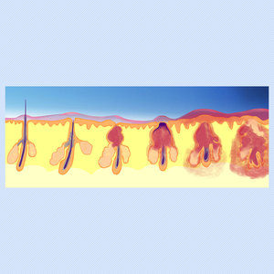 Manufacturer Hot Sale <b>Oxygen</b> Facial <b>Machine</b> Hydrating Anti-Aging Acne Treatment Deep Cleaning Skin Rejuvenation - Product Image 5