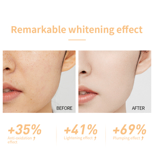 LANBENA Saudi Anti Aging Ginseng Grüner Tee Vitamin C Gesichts creme White ning für Frauen Die und Falten Niacin amid Gesichts creme Sicherheits datenblatt - Product Image 6