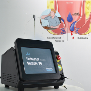 Dispositivo Láser de Diodo Portátil de 1470nm y 980nm para Proctología, Cirugía de Hemorroidectomía, Tratamiento de Fístulas Anales y Hemorroides - Product Image 1