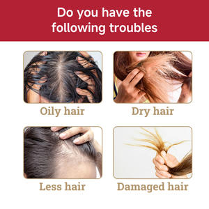 Aceite de tratamiento para el crecimiento del cabello para el cuidado personal para engrosar el cabello y reducir la pérdida de cabello - Product Image 2