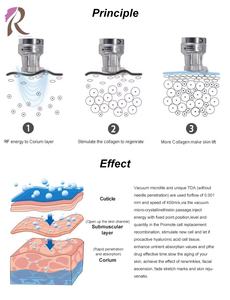 2026 nuova macchina Nano <span class=keywords><strong>Micro</strong></span>-cristallo aggiornata per un miglioramento efficiente delle rughe di idratazione e una terapia Meso che stringe la pelle - Product Image 2