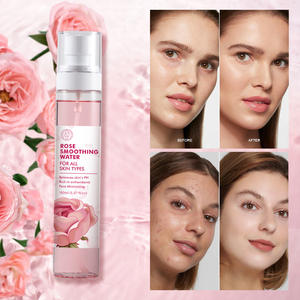 Tónico Facial Hidratante Natural <span class=keywords><strong>de</strong></span> Marca Privada <span class=keywords><strong>de</strong></span> 150 ml, <span class=keywords><strong>Spray</strong></span> Facial <span class=keywords><strong>de</strong></span> <span class=keywords><strong>Rosas</strong></span>, <span class=keywords><strong>Agua</strong></span> <span class=keywords><strong>de</strong></span> <span class=keywords><strong>Rosas</strong></span> <span class=keywords><strong>para</strong></span> el Rostro - Product Image 6