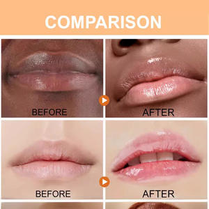 Bálsamo labial personalizado de marca propia, hidratante, que atenúa las líneas de los labios, bálsamo labial de cúrcuma, bálsamo labial en mantequilla. - Product Image 3