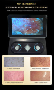 Taibo Hydra Oxygen Machine de microdermabrasion faciale <span class=keywords><strong>Aqua</strong></span> Jet Peel Nettoyage du visage Hydrodermabrasion Hydro Facial Machine - Product Image 4