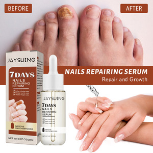 Suero Reparador de Uñas Herbal Efectivo JAYSUING, <span class=keywords><strong>Tratamiento</strong></span> para <span class=keywords><strong>Hongos</strong></span> <span class=keywords><strong>en</strong></span> las Uñas <span class=keywords><strong>en</strong></span> 7 Días - Product Image 5