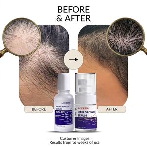 Suero Profesional para el Crecimiento del Cabello, Fórmula Avanzada <span class=keywords><strong>RCP</strong></span>+A, Cuidado Clínico para la Densidad del Cabello, para Cabello Debilitado por el Postparto y el Estrés - Product Image 4