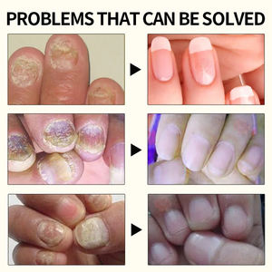 Suero Reparador de Uñas Natural de 15 ml, Antibacteriano y Antifúngico, Venta al por Mayor de Fabricante OEM - Product Image 6