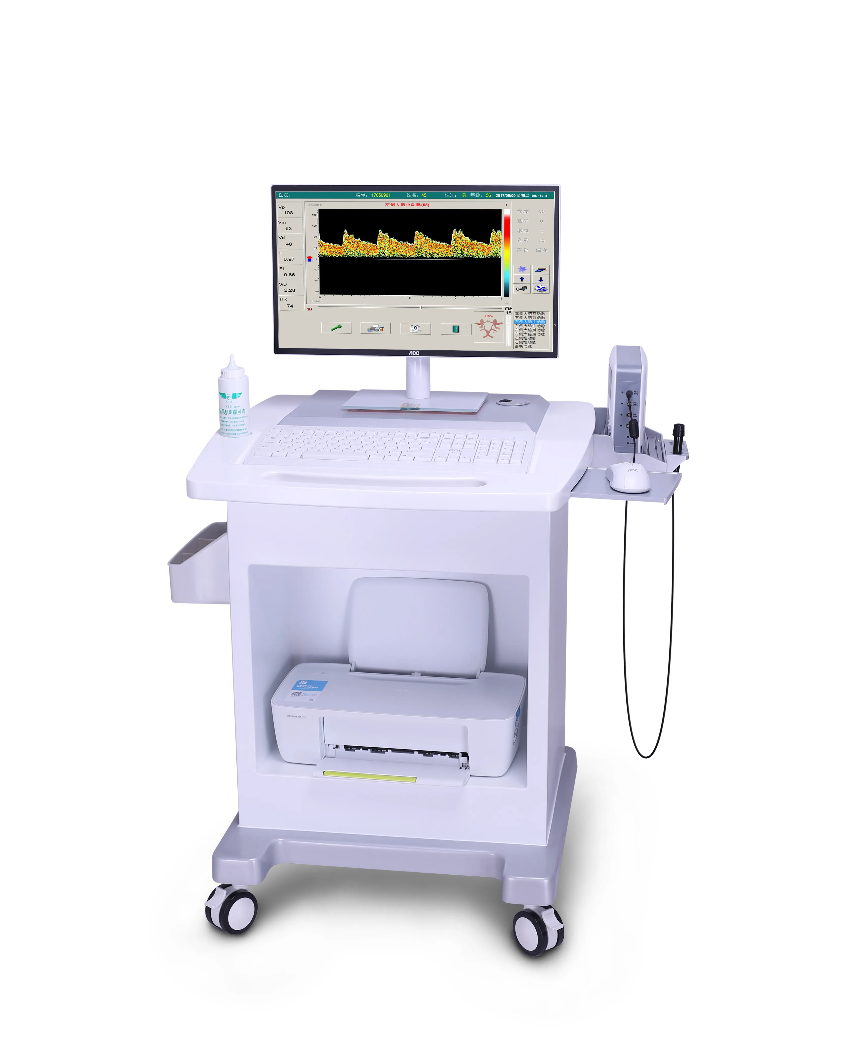 2022 Nieuwe Tcd Transcraniële Doppler Ultrageluid Systeem Voor Neurologie