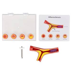 Modelo Anatómico de <span class=keywords><strong>Arteriosclerosis</strong></span> de 4 Partes con Sección Transversal de Arteria, Modelo de Ciencia Médica para Enseñanza Médica a Pacientes y Doctores - Product Image 6