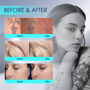 GRAN OFERTA: Máquina Portátil de Eliminación de Tatuajes <span class=keywords><strong>con</strong></span> Láser Nd YAG, Sistema de Borrado de Tatuajes de <span class=keywords><strong>Cejas</strong></span> de Pulso Largo para Eliminación Permanente en Salones de Belleza - Product Image 5