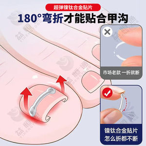 [Xin Zhangmen] Corrector de Uñas Encarnadas de Acero y Plástico Compuesto * Set/Caja al por Mayor para Uñas Encarnadas - Product Image 2