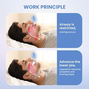 効果的ないびき防止ソリューション調整可能な夜間睡眠補助プロフェッショナル & 再利用可能ないびき防止マウスピースマウスガード - Product Image 5