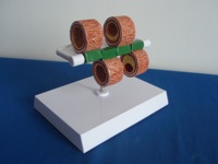 Modelo Anatómico de Vascular Humano de Cuatro Etapas (Plástico) para Ilustrar la Enfermedad de Arteriosclerosis, Fabricado en China