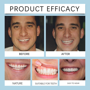 مجموعات تشطيب الأسنان الاصطناعية، مجموعات تجميل الأسنان الاصطناعية لتحسين جمال الابتسامة وراحة الأسنان الاصطناعية - Product Image 4