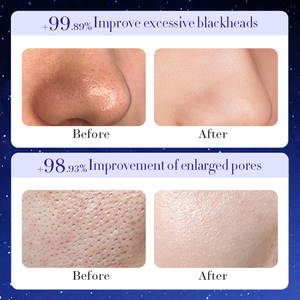 SADOER Starry Sky Lágrimas Limpieza Eliminación de espinillas Máscara Inglés Ventas directas de fábrica Máscara facial y corporal negra - Product Image 6