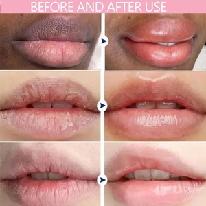 Sérum Lèvres Rose Uiz – Traitement Végétalien Hydratant et Exfoliant pour Lèvres Foncées – Éclaircissant 24H Jour & Nuit - Product Image 2
