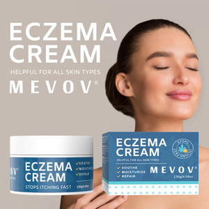 Crema para Eczema y Psoriasis de Marca Privada con Glicerina para Hidratar, Reducir el Enrojecimiento, Efectos <span class=keywords><strong>Antiinflamatorios</strong></span> y Nutritivos - Product Image 2