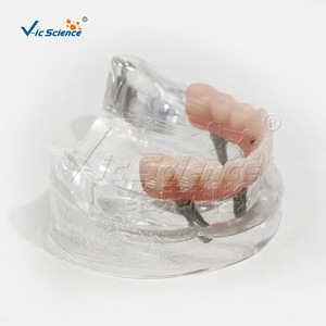 Modelo de restauración de implantes mandibulares de alta precisión M6001-1; Demostración de restauración Ma Longqiao; Entrenamiento para la escuela de medicina. - Product Image 4