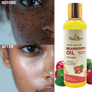 Etiqueta privada vegana vitamina C productos para el cuidado de la piel blanqueamiento de la piel incluso el tono de la piel ACEITE DE Arbutina Aceite Corporal de gayuba para piel negra - Product Image 2