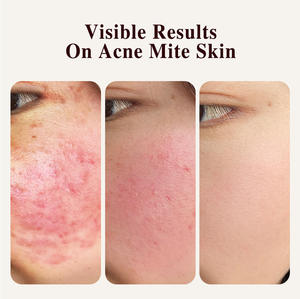 Organico Private Label pelle schiarente alleggerimento bagno sbiancante corpo viso sbiancamento acaro rimozione sapone - Product Image 6