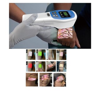 جهاز محمول للكشف عن الأوردة بالأشعة تحت الحمراء للحقن الوريدي، جهاز مراقبة بيطري، محدد مواقع للممرضات والطاقم الطبي - Product Image 2