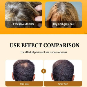 Olio di Batana per la crescita dei capelli Spray lasciare nel siero balsamo per le donne gli uomini addensare idratare rafforzare il <span class=keywords><strong>trattamento</strong></span> del cuoio capelluto olio per capelli - Product Image 4