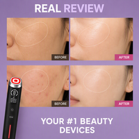 Appareil de traitement nettoyant et liftant anti-âge 6 en 1 pour le visage, micro-courant, mini-appareil de tonification du visage, booster de peau, appareil de massage professionnel