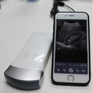Mesin <span class=keywords><strong>Ultrasound</strong></span> Nirkabel Portabel Multi-Sistem SonoStar - Product Image 4