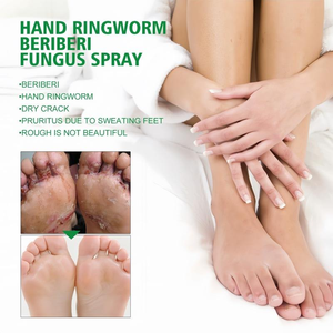 Juego <span class=keywords><strong>de</strong></span> alivio <span class=keywords><strong>del</strong></span> <span class=keywords><strong>pie</strong></span> <span class=keywords><strong>de</strong></span> atleta: contiene spray <span class=keywords><strong>y</strong></span> crema antimicóticos naturales, con una fórmula herbal para aliviar la picazón <span class=keywords><strong>y</strong></span> el <span class=keywords><strong>dolor</strong></span> - Product Image 5