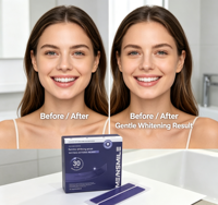 Strip Pemutih Gigi Ungu Home Dental, Aman untuk Gigi Sensitif, Label Pribadi, Stok Grosir, Pasokan Grosir