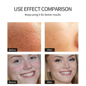 <span class=keywords><strong>Masque</strong></span> facial pour hommes, produit de beauté biologique, bon marché - Product Image 5