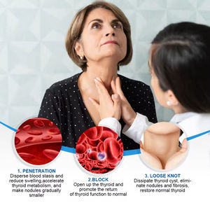 แผ่นแปะสมุนไพรจีน 8 ชิ้น สำหรับดูแลสุขภาพต่อมไทรอยด์ แผ่นแปะจมูกและร่างกาย สำหรับรักษาต่อมไทรอยด์โตและต่อมน้ำเหลือง - Product Image 3